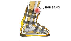 2 Pairs of Ski Shin Protectors